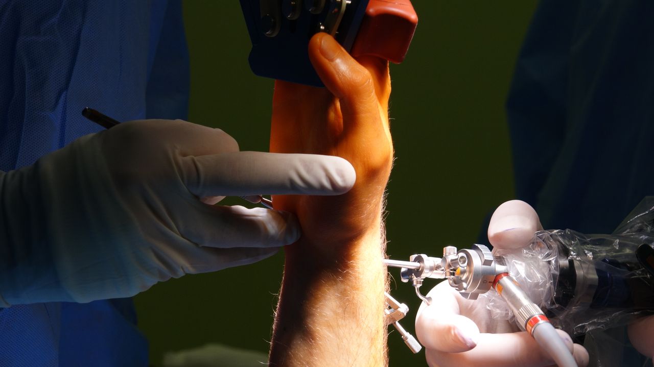 Detailed view of wrist surgery procedure with medical instruments and gloved hands.